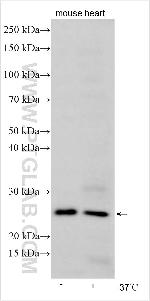 PLA2G4A Antibody in Western Blot (WB)