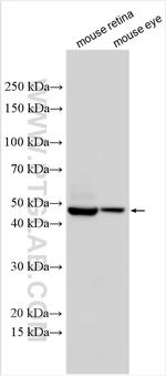 Thyroid Hormone Receptor beta Antibody in Western Blot (WB)