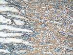 CRYBB3 Antibody in Immunohistochemistry (Paraffin) (IHC (P))