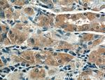 CRYBB3 Antibody in Immunohistochemistry (Paraffin) (IHC (P))