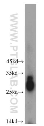 CRYBB3 Antibody in Western Blot (WB)