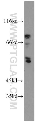 ENTPD8 Antibody in Western Blot (WB)