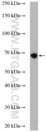 Alkyl-DHAP synthase/AGPS Antibody in Western Blot (WB)