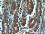 CLEC18A Antibody in Immunohistochemistry (Paraffin) (IHC (P))