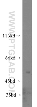 CLEC18A Antibody in Western Blot (WB)