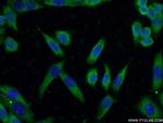 KIAA0319L Antibody in Immunocytochemistry (ICC/IF)