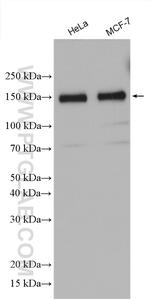 KIAA0319L Antibody in Western Blot (WB)