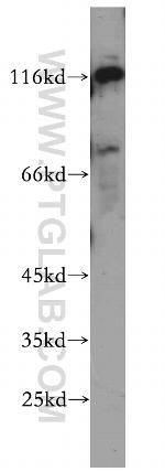 KIAA0319L Antibody in Western Blot (WB)