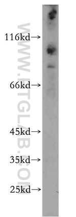 KIAA0319L Antibody in Western Blot (WB)