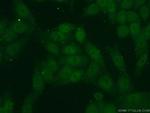 KLF5 Antibody in Immunocytochemistry (ICC/IF)