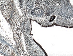 KLF5 Antibody in Immunohistochemistry (Paraffin) (IHC (P))