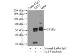 KLF5 Antibody in Immunoprecipitation (IP)