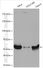 KLF5 Antibody in Western Blot (WB)