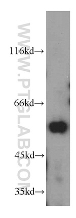 KLF5 Antibody in Western Blot (WB)