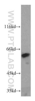 KLF5 Antibody in Western Blot (WB)