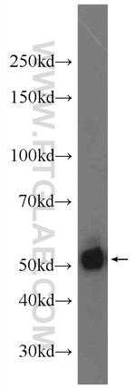 KLF5 Antibody in Western Blot (WB)