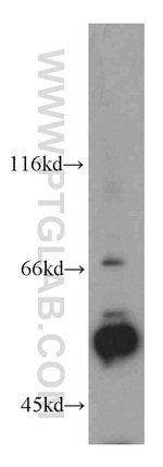 KLF5 Antibody in Western Blot (WB)