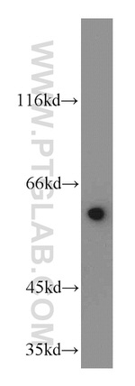 KLF5 Antibody in Western Blot (WB)