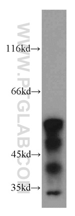 KLF5 Antibody in Western Blot (WB)