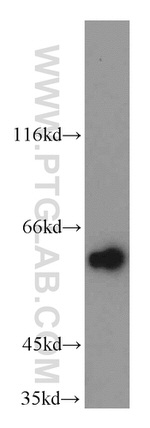 KLF5 Antibody in Western Blot (WB)
