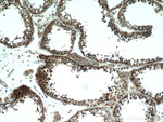 PDXDC1 Antibody in Immunohistochemistry (Paraffin) (IHC (P))