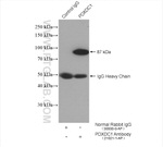 PDXDC1 Antibody in Immunoprecipitation (IP)