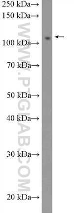 FAM186B Antibody in Western Blot (WB)