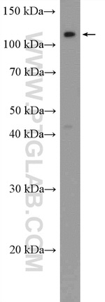 FAM186B Antibody in Western Blot (WB)