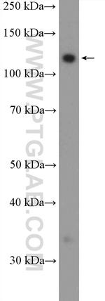 FAM186B Antibody in Western Blot (WB)