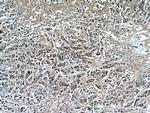 RNF170 Antibody in Immunohistochemistry (Paraffin) (IHC (P))