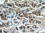RNF170 Antibody in Immunohistochemistry (Paraffin) (IHC (P))