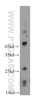 RNF170 Antibody in Western Blot (WB)