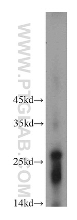 RNF170 Antibody in Western Blot (WB)