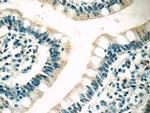 MC3R Antibody in Immunohistochemistry (Paraffin) (IHC (P))
