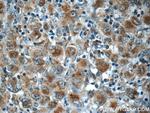 RNF213 Antibody in Immunohistochemistry (Paraffin) (IHC (P))