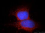 FSD1L Antibody in Immunocytochemistry (ICC/IF)