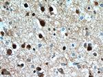 FSD1L Antibody in Immunohistochemistry (Paraffin) (IHC (P))