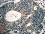 FAM78A Antibody in Immunohistochemistry (Paraffin) (IHC (P))