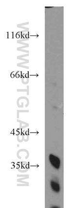 FAM78A Antibody in Western Blot (WB)