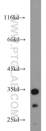 FAM78A Antibody in Western Blot (WB)