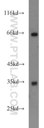 FAM78A Antibody in Western Blot (WB)