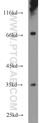 FAM78A Antibody in Western Blot (WB)