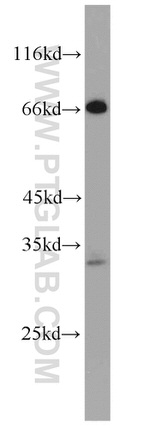 FAM78A Antibody in Western Blot (WB)