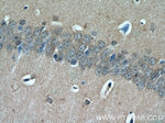 TMX3 Antibody in Immunohistochemistry (Paraffin) (IHC (P))