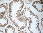 TMX3 Antibody in Immunohistochemistry (Paraffin) (IHC (P))