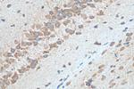 TMX3 Antibody in Immunohistochemistry (Paraffin) (IHC (P))