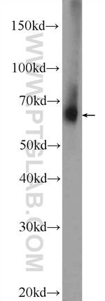 TMX3 Antibody in Western Blot (WB)