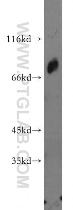 MED26 Antibody in Western Blot (WB)