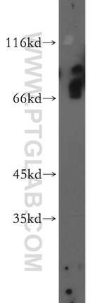 MED26 Antibody in Western Blot (WB)