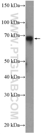 ESRP1 Antibody in Western Blot (WB)